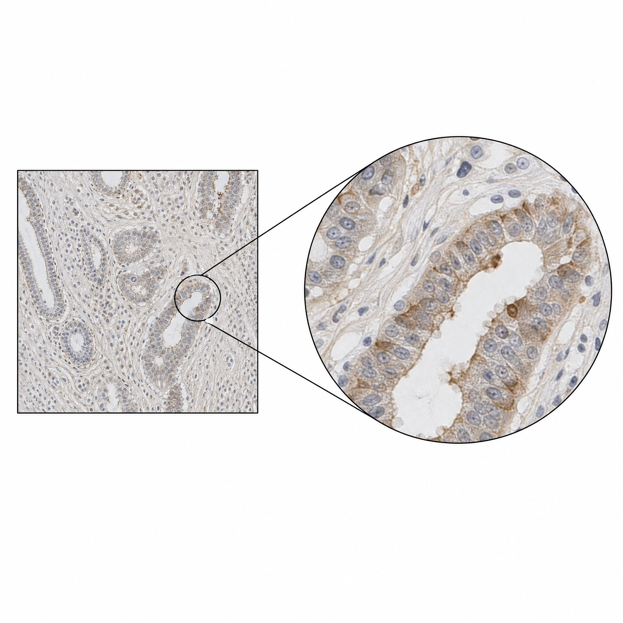 Magnifier callout enlarging a small region of a microscopy-style image panel into a larger circle (Figure generated with SciFig)