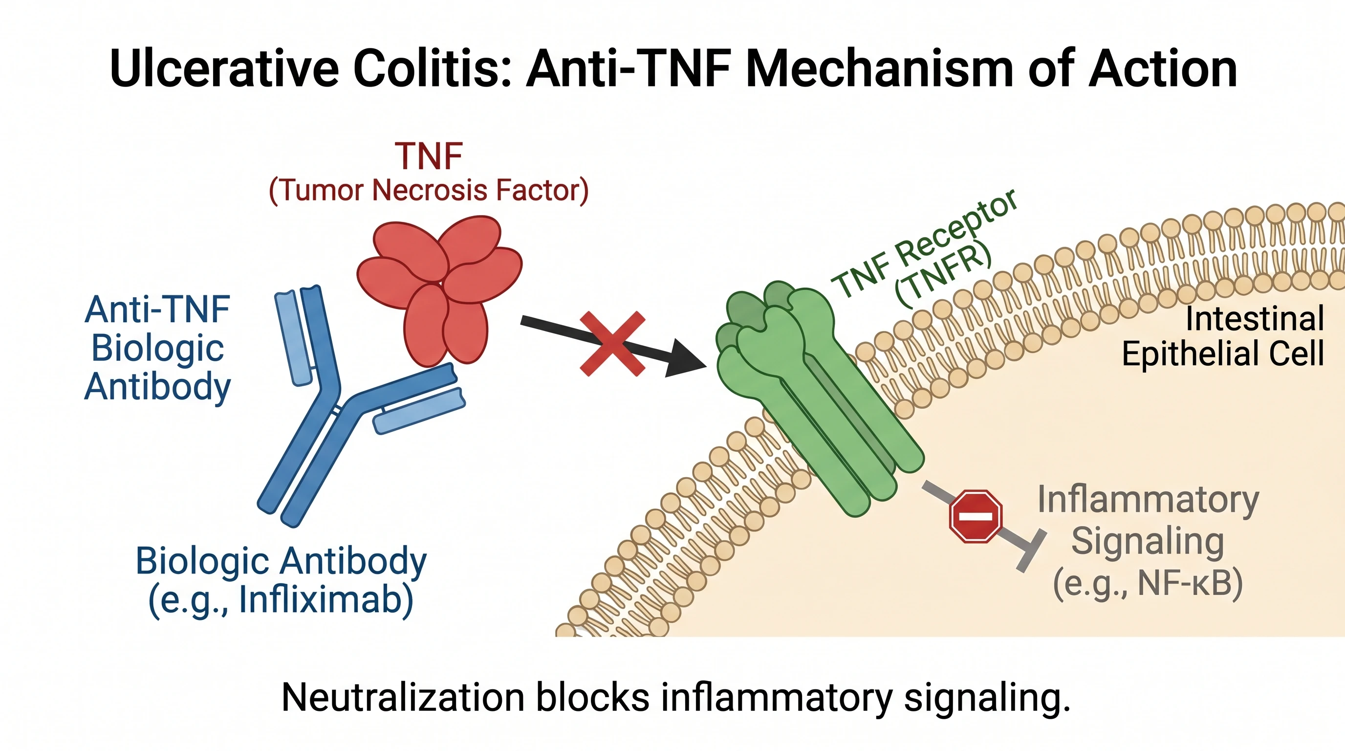 Anti-TNF biologic neutralizing TNF to block inflammatory signaling in ulcerative colitis (Figure generated with SciFig)