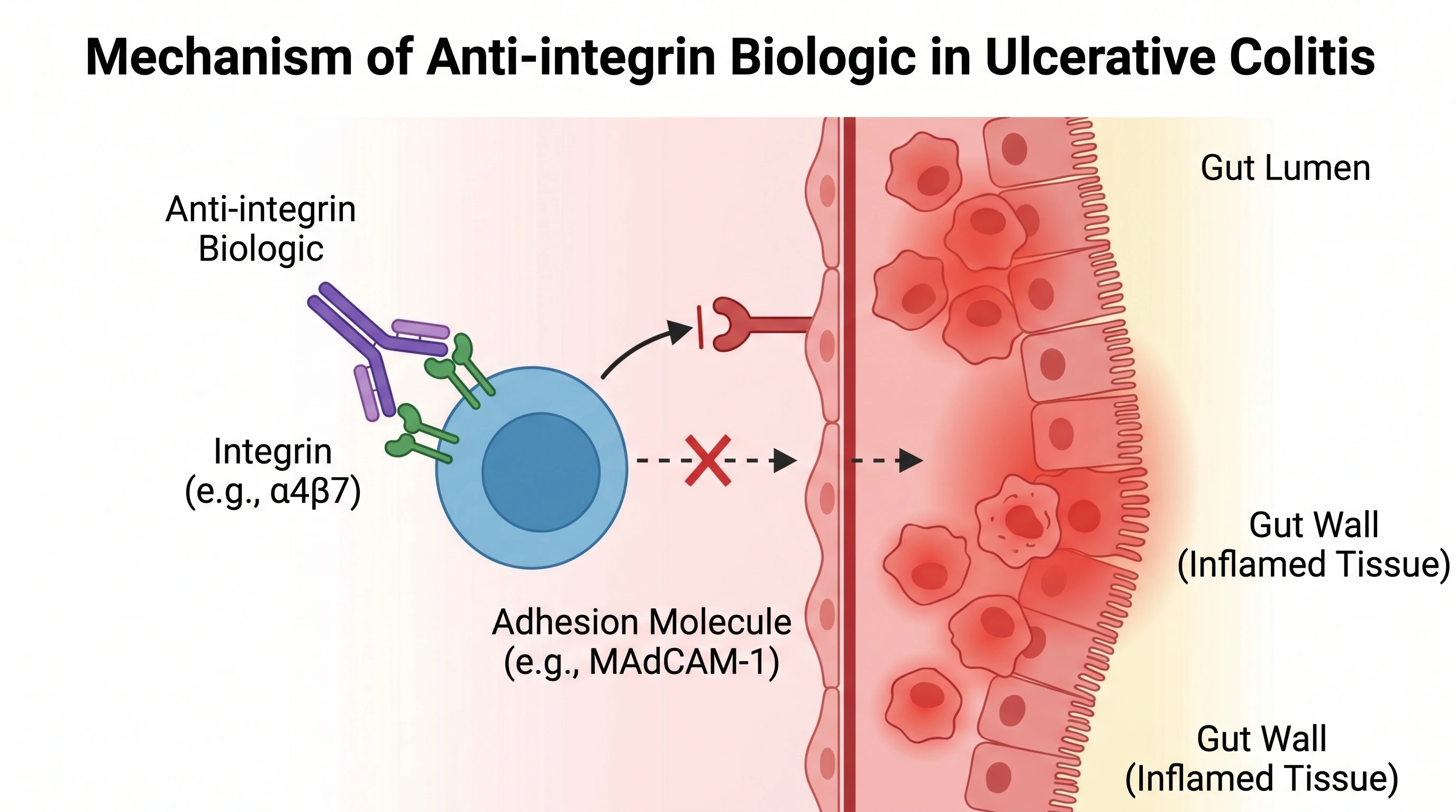 Anti-integrin biologic blocking immune cell gut-homing in ulcerative colitis (Figure generated with SciFig)